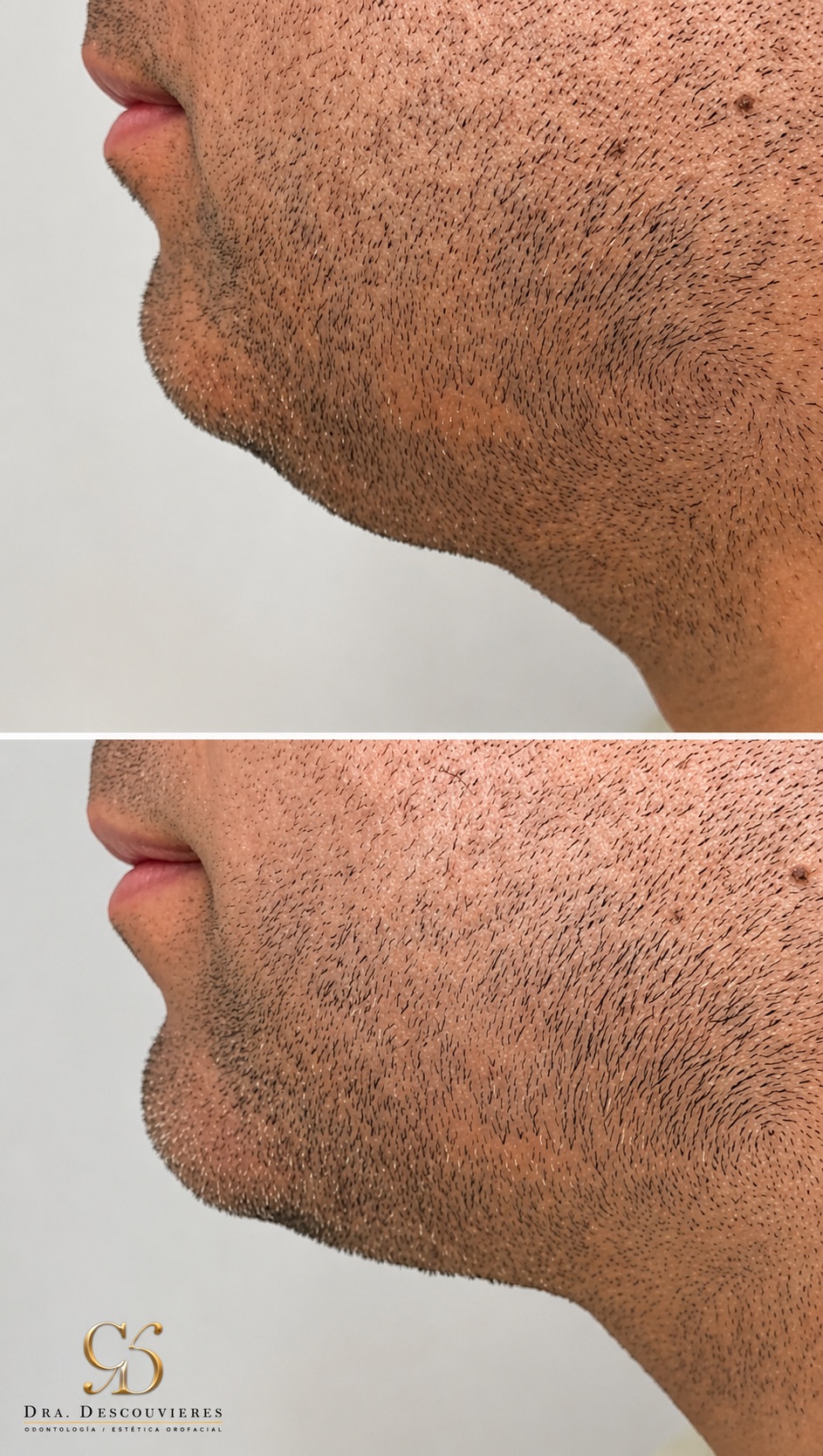 Perfil y contorno