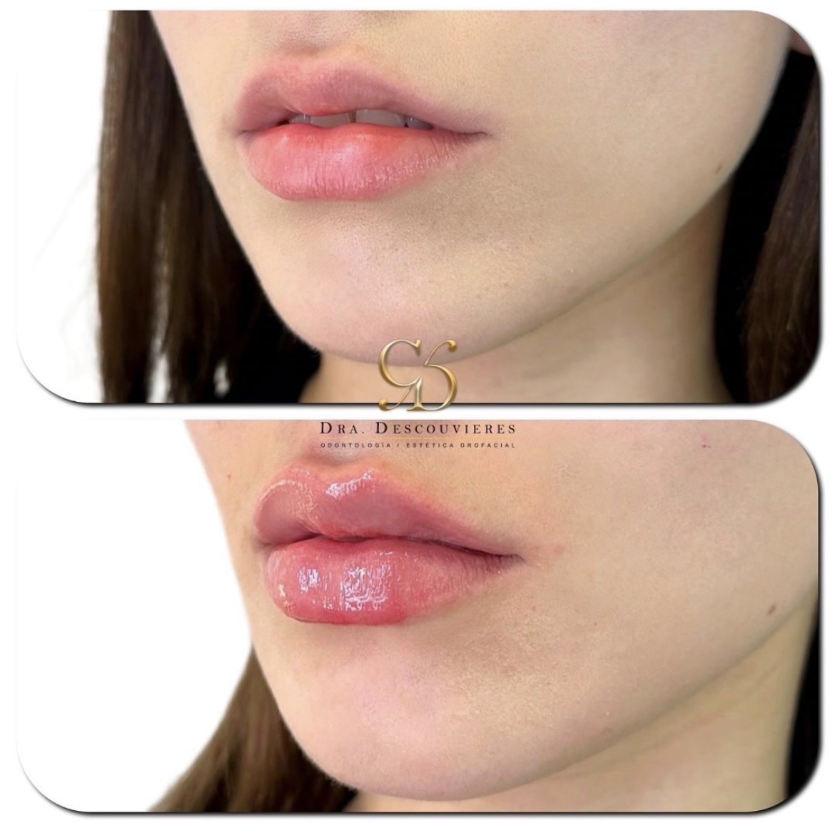 Armonización labial