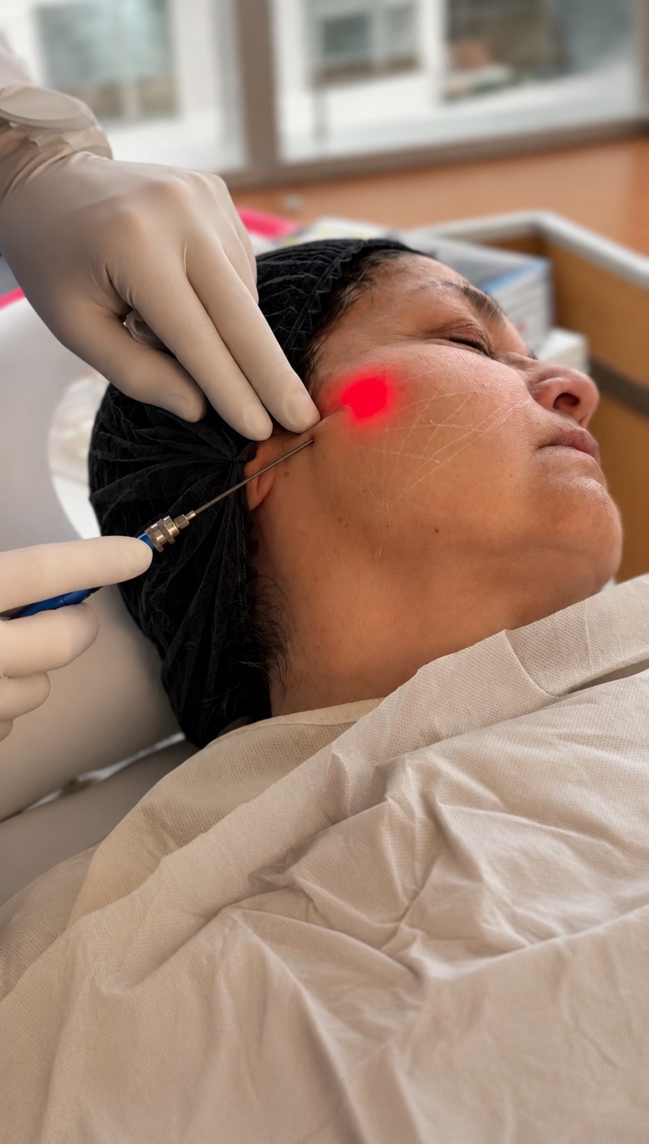 Procedimiento facial