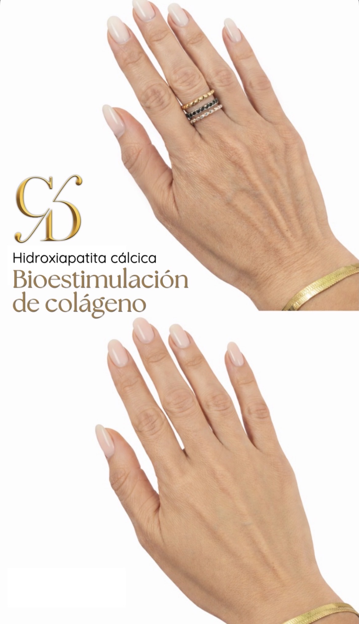 Tratamiento corporal